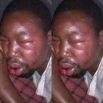 This Is Inhuman, Man Severely Injured By Mob over Refusal Of Genital Mutilation For His Daughter