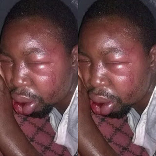 This Is Inhuman, Man Severely Injured By Mob over Refusal Of Genital Mutilation For His Daughter